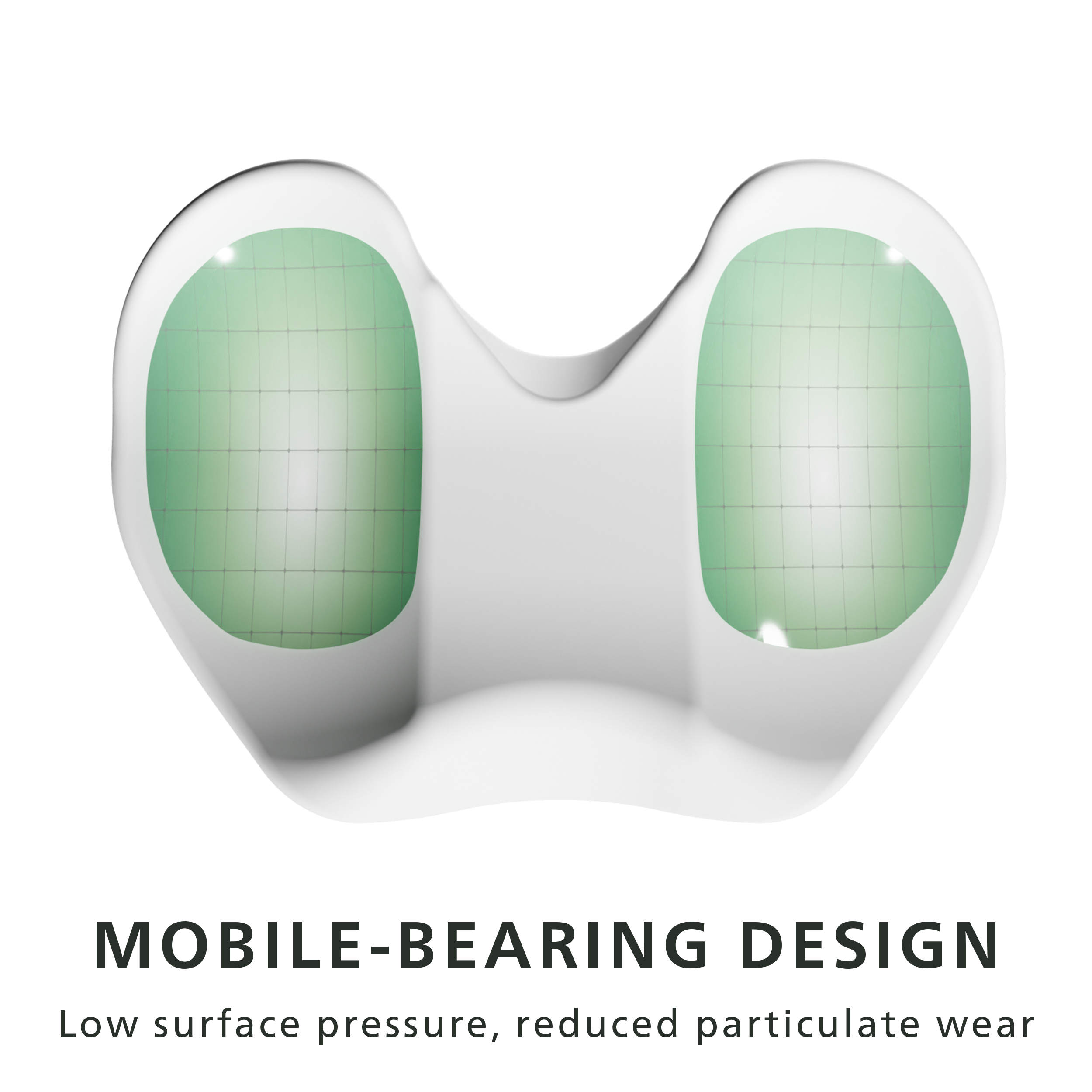 Anatomical shape and mobile bearing design