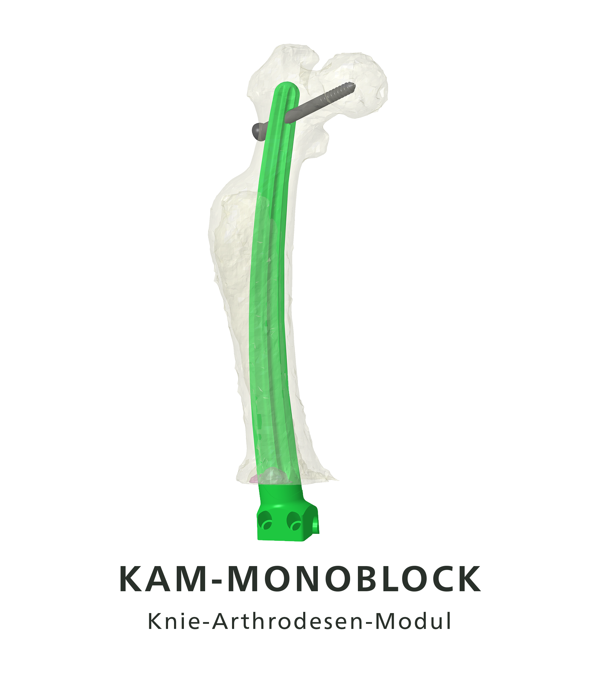 Kniearthrodesensystem KAM-Titan, hier Monoblock